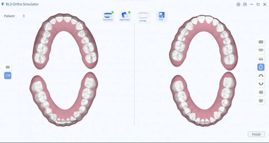 INO100PLUS INTRAORAL SCANNER