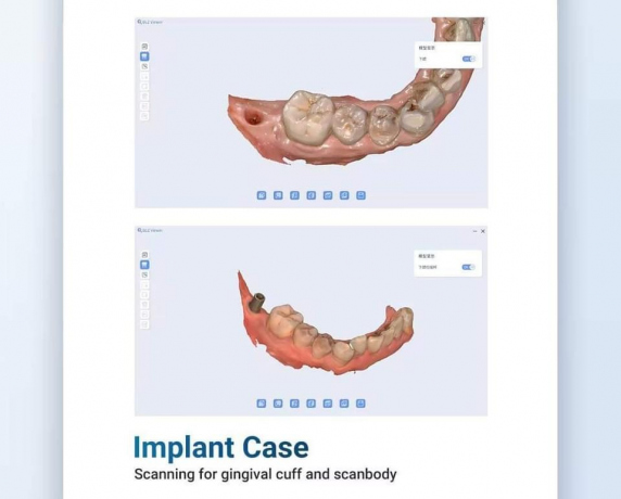 INO100PLUS INTRAORAL SCANNER