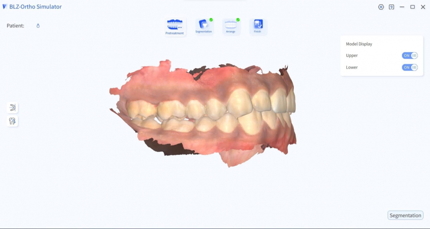 INO100PLUS INTRAORAL SCANNER