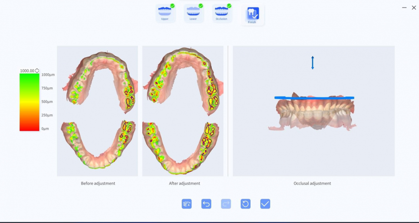 INO100PLUS INTRAORAL SCANNER